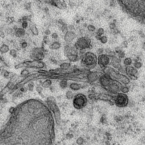 coronavirus