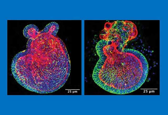 Photomicrographs of tissue taken from the intestines of infant mice