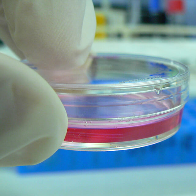 A close-up of a small petri dish being held between two gloved fingers.